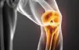 Cyclist’s Tendinitis