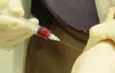 Focus on PRP