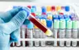 Everything you need to know about blood tests for athletes