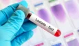 Lactate in Cycling: Deciphering a Key Performance Indicator